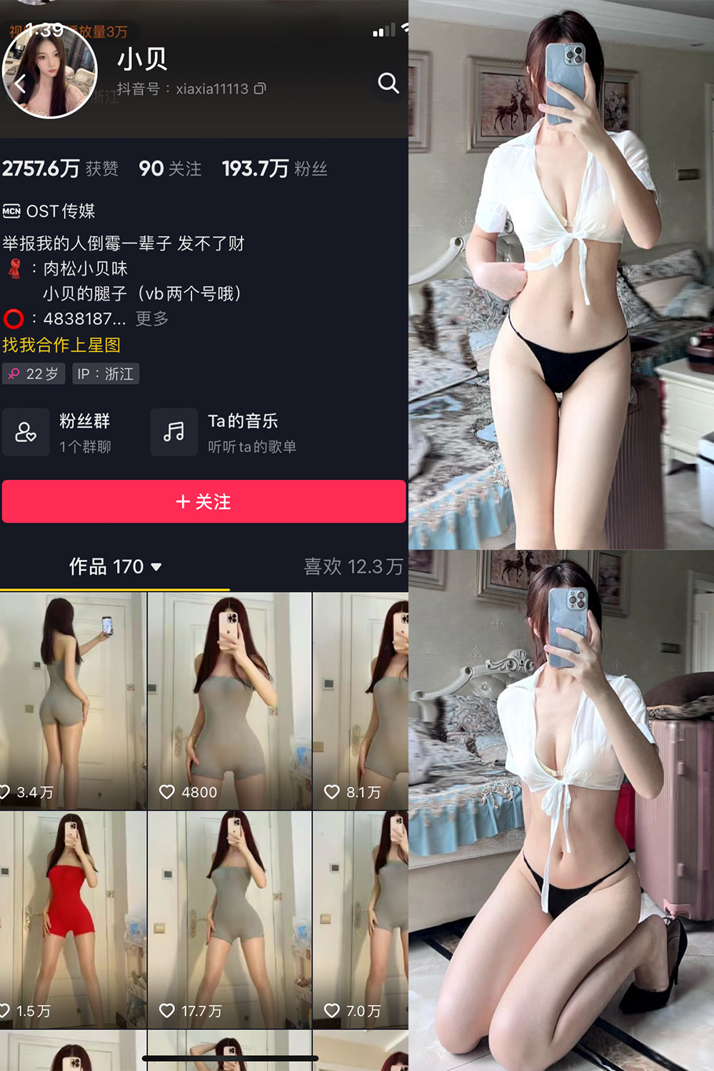 小贝 VIP 微密圈  NO.005期